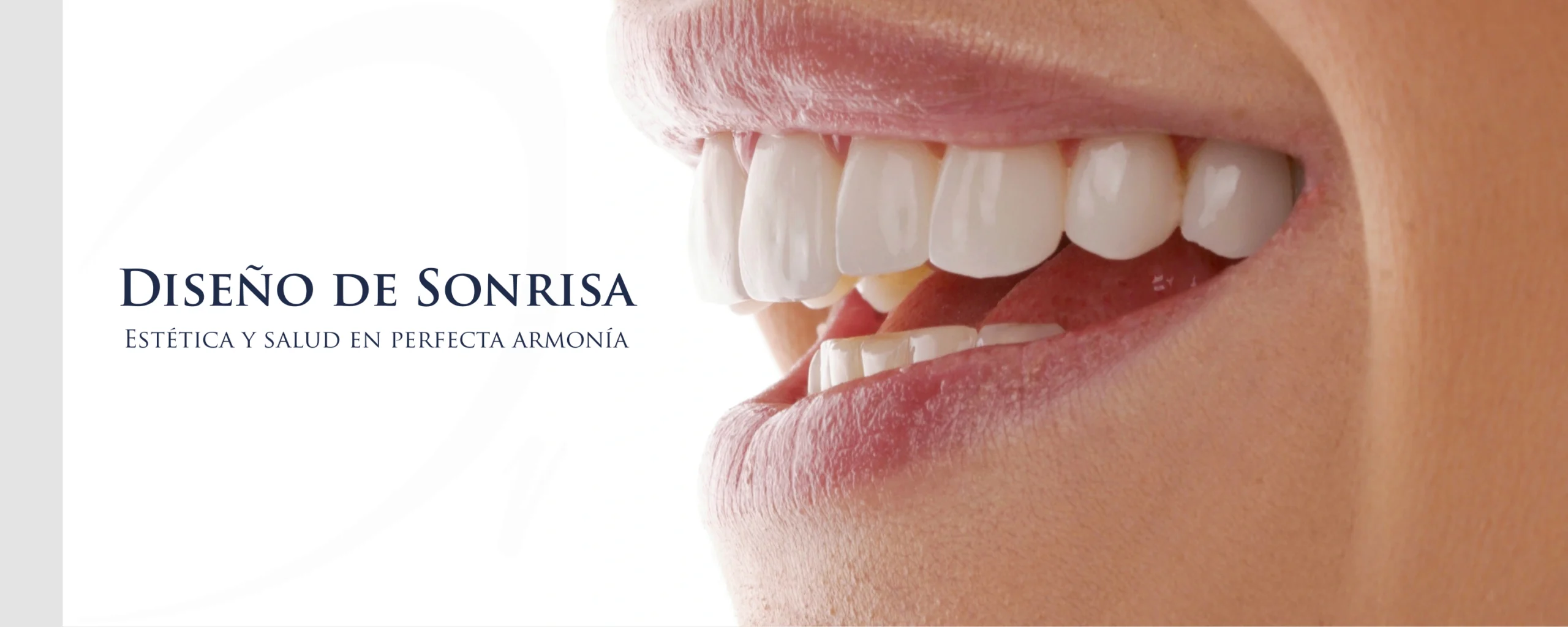 Diseño de Sonrisa Natural